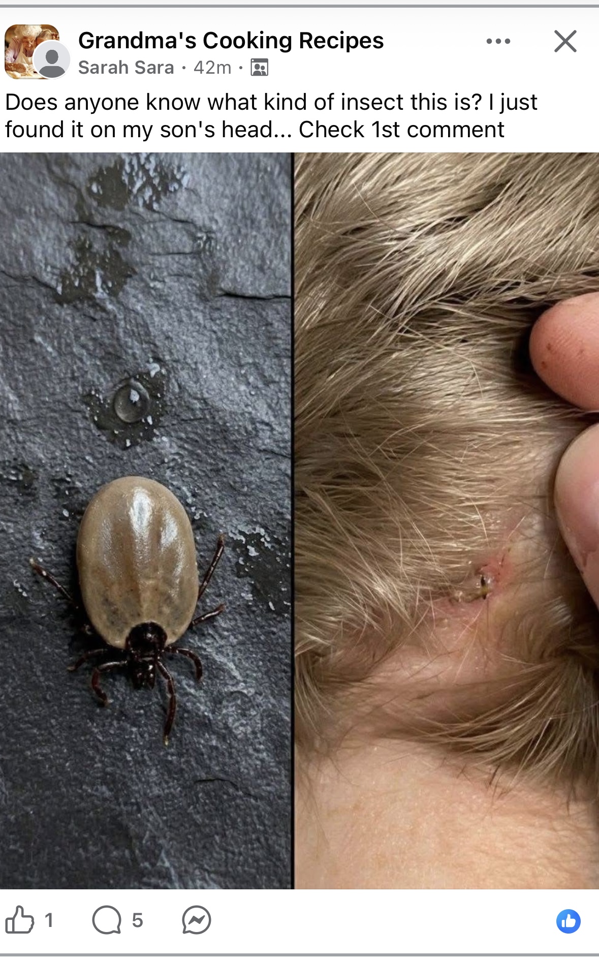 Facebook post asking about an insect found on son's head - showing a tick